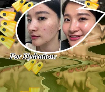 Best korean skincare for pigmentation